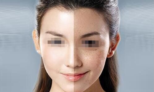 衡陽雅美14周年慶vip專場：寶尼達私享會，玻尿酸買2送2優(yōu)惠限時開啟