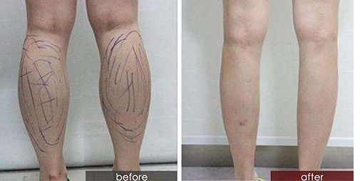 【2024廣州雙眼皮整形醫(yī)院排行榜】推薦三家專業(yè)醫(yī)院