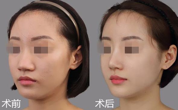 廣州拉皮哪家醫(yī)生技術(shù)比較好？TOP5名醫(yī)大揭秘