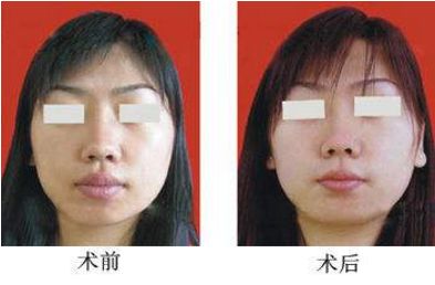 杭州哪家整形醫(yī)院口碑比較好，推薦浙江醫(yī)美排行榜前十佳