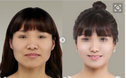 梅州皇佳貝麗整形醫(yī)院2023全新提升，醫(yī)療技術(shù)引領(lǐng)新潮流