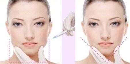 麗水市人民醫(yī)院整形外科可信賴嗎？詳細資料+收費明細，快來了解！