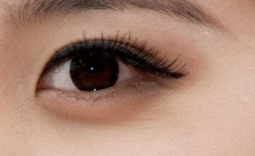 重慶軍美吸脂效果怎么樣？真實案例見證顯著術(shù)后效果