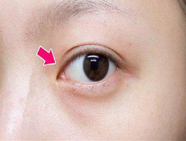 揚州哪家整形醫(yī)院技術(shù)好？