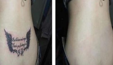 雙眼皮手術(shù)醫(yī)院推薦，一站式解決開(kāi)眼角問(wèn)題