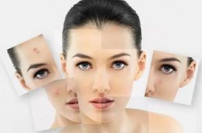 中國醫(yī)療界公布北京針對祛斑的醫(yī)院排行榜