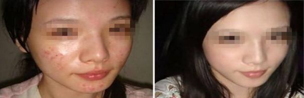 漢濤縣矯形醫(yī)院整形科好不好