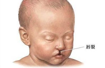 最新盤點：沈陽隆胸整形醫(yī)院大排行，人氣醫(yī)生與價格揭秘