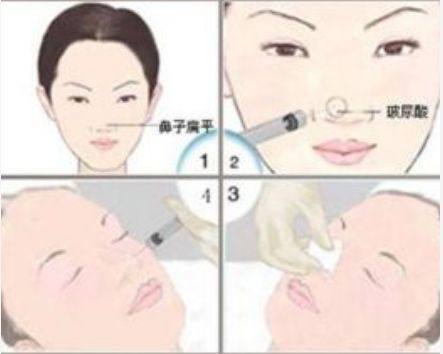 邯鄲維多利亞美容醫(yī)院體驗(yàn)全解析：門診介紹及價(jià)格指南