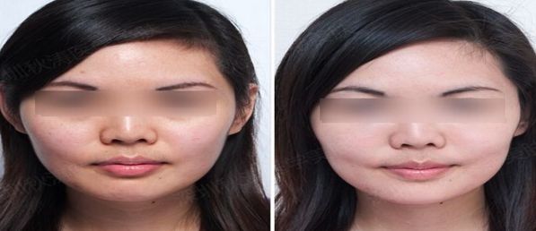 北京醫(yī)美行業(yè)領(lǐng)先者揭曉，排名前十大公示