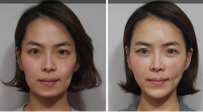 2024廣州市內(nèi)哪家整形醫(yī)院真正靠譜？