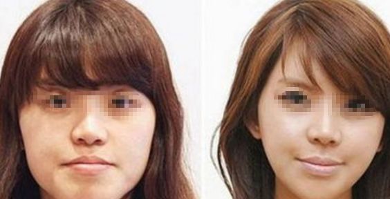 【2024】武漢整形醫(yī)院推薦前十強