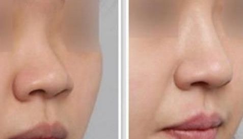 沈陽杏林醫(yī)院官網(wǎng)詳解領(lǐng)先技術(shù)，臉部果展示讓你重獲自信