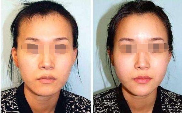 汕頭哪家雙眼皮整形醫(yī)院口碑好