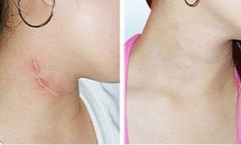 滄州京美醫(yī)療美容服務(wù)項(xiàng)目一覽表，請(qǐng)您參考