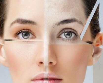 11月16日，喬雅登緹顏國內(nèi)首發(fā)發(fā)布會(huì)震撼北京，沈陽百嘉麗首發(fā)力挺