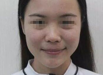 南充疤痕整形醫(yī)院排名精選，助你尋找完美去疤痕之旅