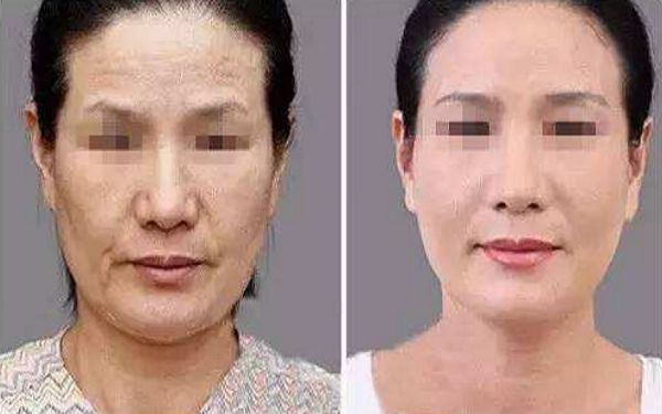 2024年連云港整形醫(yī)院專業(yè)排行榜出爐，你知道嗎？