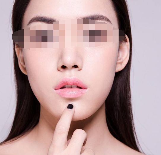 廣州整形哪家醫(yī)院治療肋骨鼻效果好