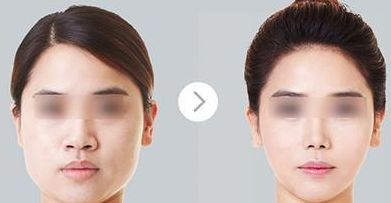 廣州耳再造醫(yī)院綜合評價曝光，醫(yī)療技術(shù)領(lǐng)跑全國