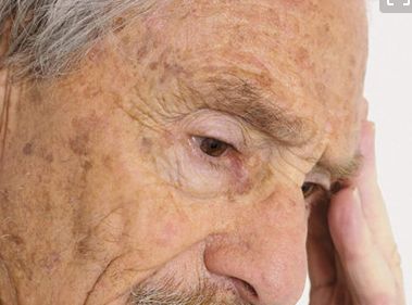 解析奧地利公主玻尿酸：探秘其S.M.A.R.T交聯(lián)技術(shù)的獨(dú)特優(yōu)勢(shì)