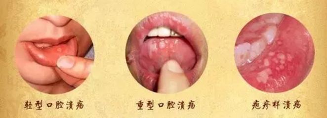 北京眼袋整形醫(yī)院排名大揭秘，最佳去眼袋選擇！