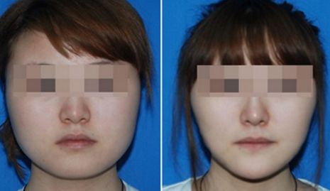 重慶普瑞眼科醫(yī)院怎么坐地鐵到