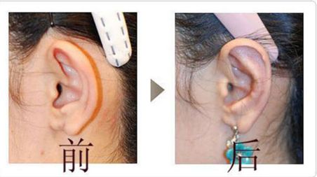 成都友誼醫(yī)院疤痕科：設(shè)備先進(jìn)、技術(shù)精湛，治療效果如何？