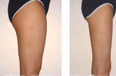 廣東燕嶺醫(yī)院胎記疤痕專家坐診時(shí)間及費(fèi)用一覽