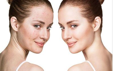 蘭州去眼袋醫(yī)院哪家好？ 一指選出專業(yè)吸脂治療