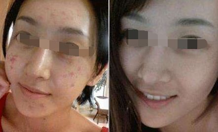 太原市最受歡迎的吸脂手術醫(yī)院前七名名單公開