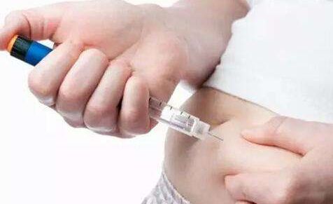 南京推薦雙眼皮手術(shù)好的頂級醫(yī)院是哪家