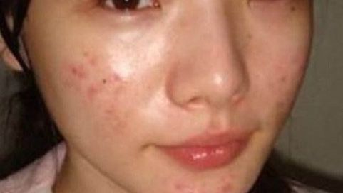 北京眼科醫(yī)院排名榜單揭曉，何氏、同仁入選！附近視眼手術(shù)費(fèi)用一覽