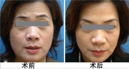 常州哪家唇部整形醫(yī)院值得信賴，價格如何？