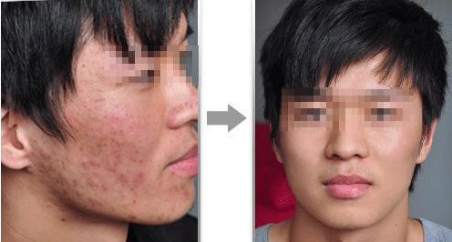 濟(jì)南高新麥昆醫(yī)療美容診所的價(jià)格如何？真實(shí)技術(shù)測評與大揭秘