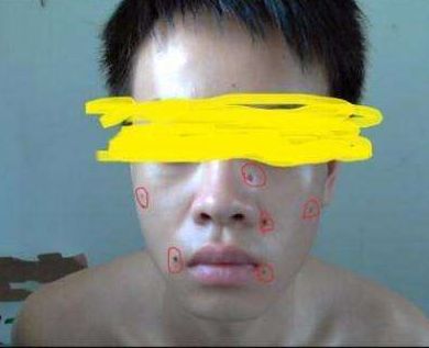 ?？谑笳吾t(yī)院匯總，哪家效果比較好？