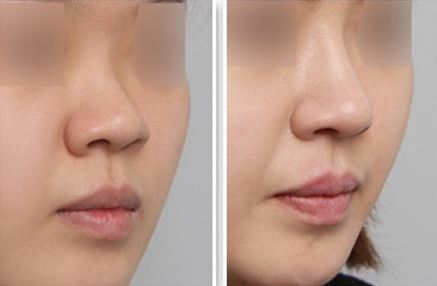 深圳整形醫(yī)院實(shí)力盤點(diǎn)！最受用戶歡迎的醫(yī)院排行榜揭曉