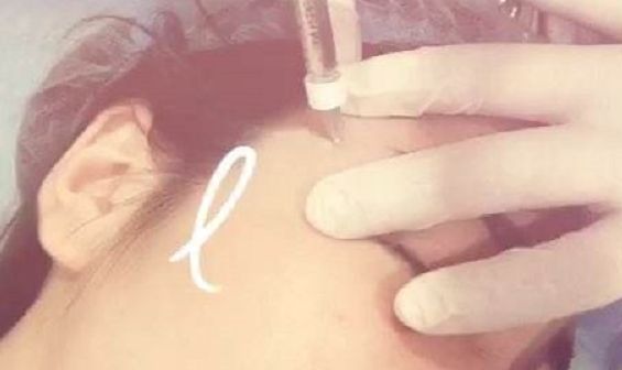 深圳前海地區(qū)哪家整形醫(yī)院比較靠譜？好的深圳整容醫(yī)院有哪些？