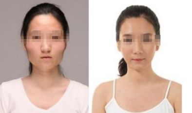 沈陽軍區(qū)總醫(yī)院整形美容科專家介紹與收費(fèi)標(biāo)準(zhǔn)