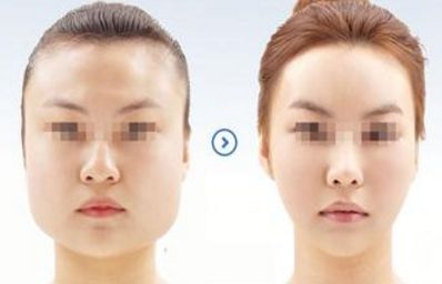 2024年溫州哪家醫(yī)院的整形美容效果最佳？