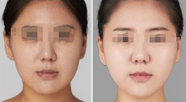 2024年惠州哪些整形醫(yī)院口碑好？