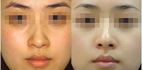 成都珀媛醫(yī)療美容服務(wù)水平如何？醫(yī)院介紹及費(fèi)用大公開