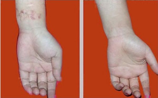 【雙眼皮專家駕到！武漢中翰整形醫(yī)院付毅院長親診雕刻美眼】