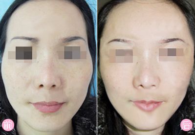 上海薇琳植發(fā)醫(yī)院地址、口碑醫(yī)生、價格表，詳細(xì)資料分享！