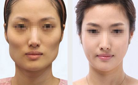 無錫哪家整形醫(yī)院排名前五比較靠譜