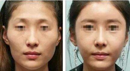 剖析米蘭柏羽皮膚科料金：熱門醫(yī)生推薦及項(xiàng)目價(jià)格一覽