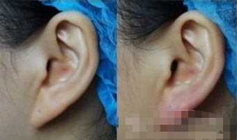 邯鄲醫(yī)美排行榜TOP5，口碑爆棚！