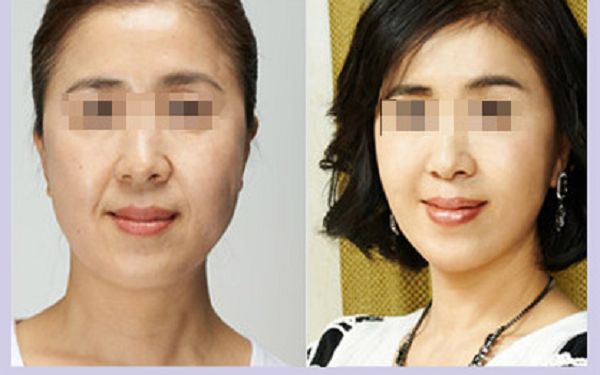 溫州哪家整形醫(yī)院口碑好？排名榜單揭曉