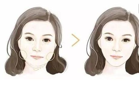 2024年最佳匯總！惠州哪家整形醫(yī)院專業(yè)祛法令紋？