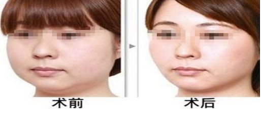 北京五家知名醫(yī)美醫(yī)院排名推薦